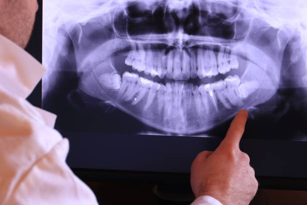 Best Emergency Root Canal Treatment in Independence, IA